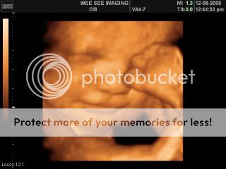 3D 4D ultrasound dates!!! :) When and HOW FAR ALONG? - BabyCenter